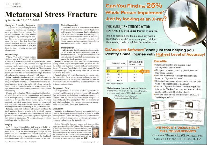 Metatarsal Stress Fracture