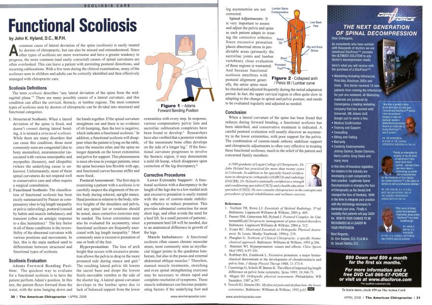 Functional Scoliosis