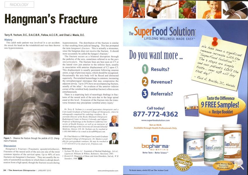 Hangman's Fracture