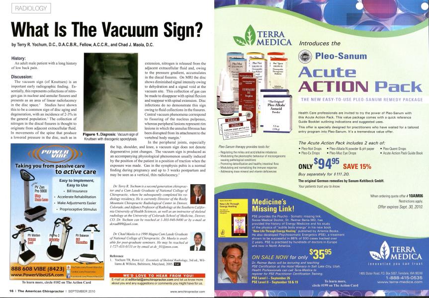 What Is The Vacuum Sign?
