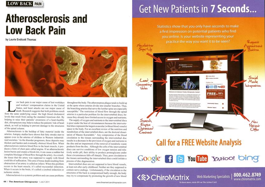 Atherosclerosis and Low Back Pain