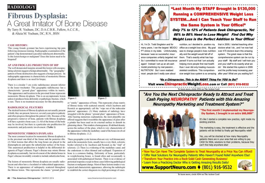 Fibrous Dysplasia: A Great Imitator Of Bone Disease