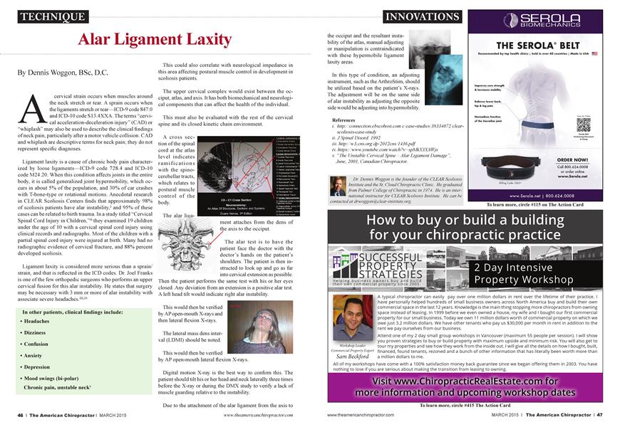Alar Ligament Laxity