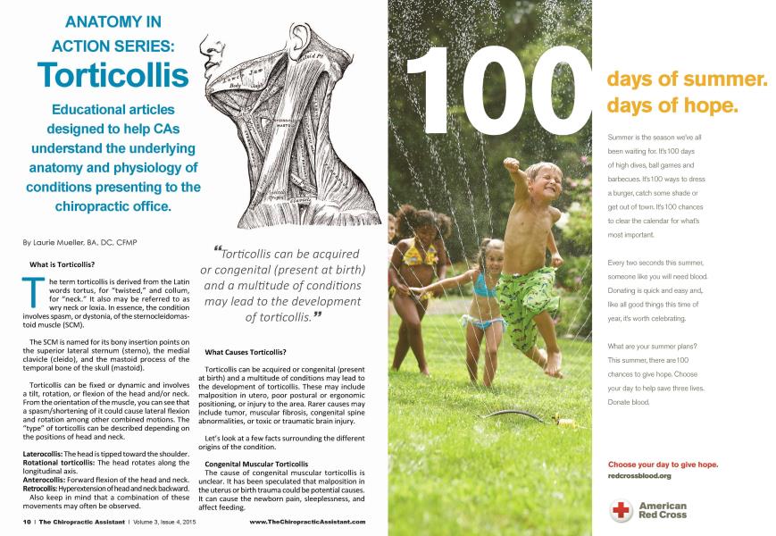 ANATOMY IN ACTION SERIES: Torticollis