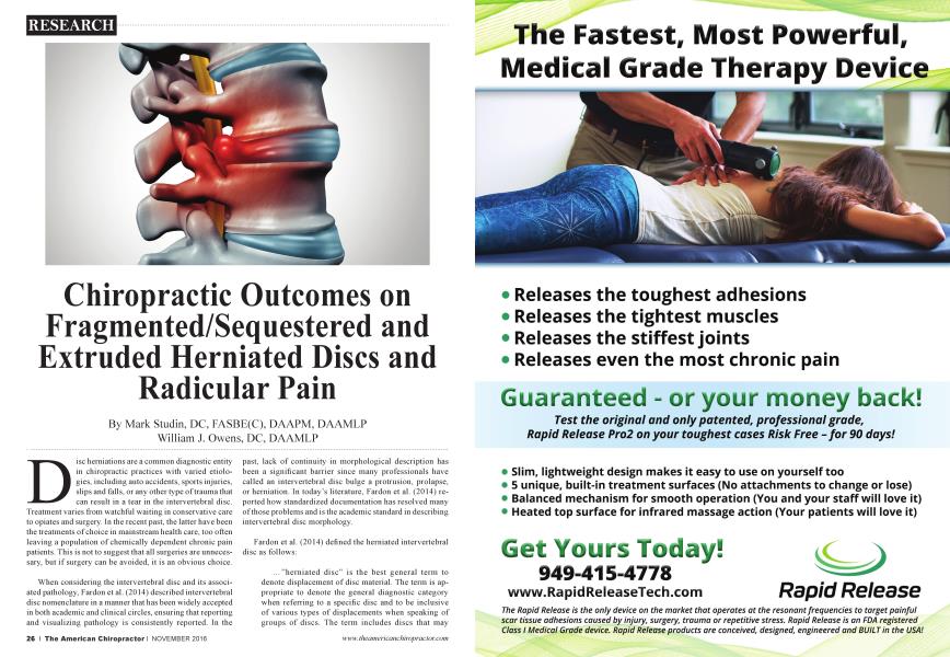 Chiropractic Outcomes on Fragmented/Sequestered and Extruded Herniated Discs and Radicular Pain