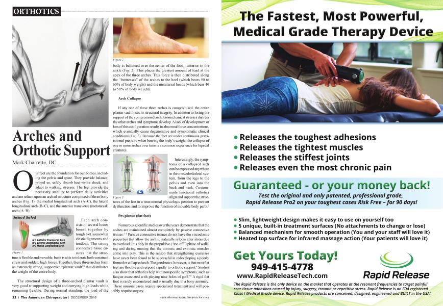 Arches and Orthotic Support