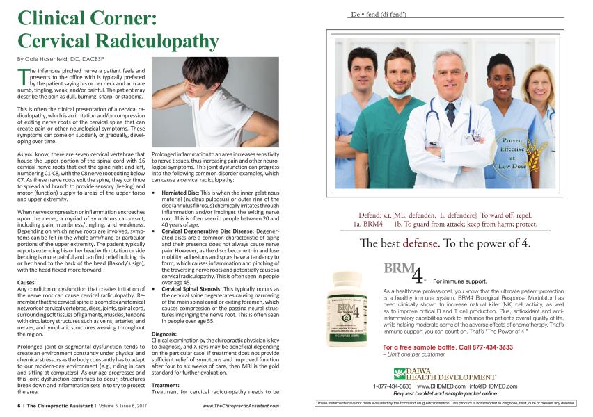 Clinical Corner: Cervical Radiculopathy