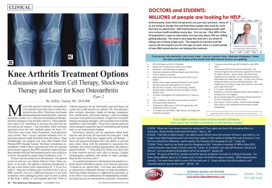 Knee Arthritis Treatment Options
