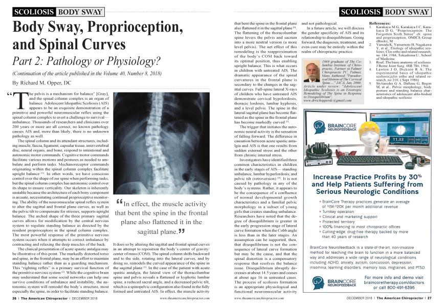 Body Sway, Proprioception, and Spinal Curves