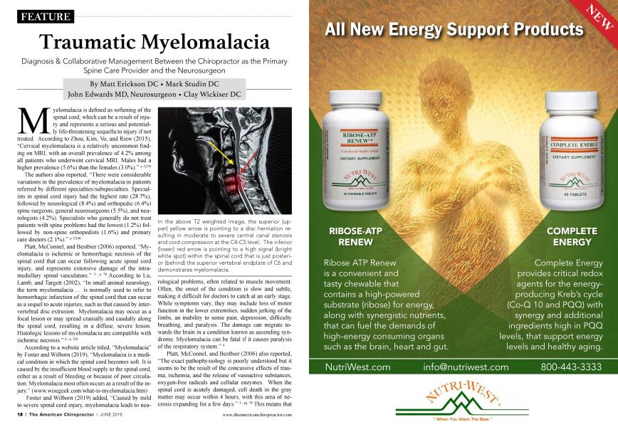 Traumatic Myelomalacia