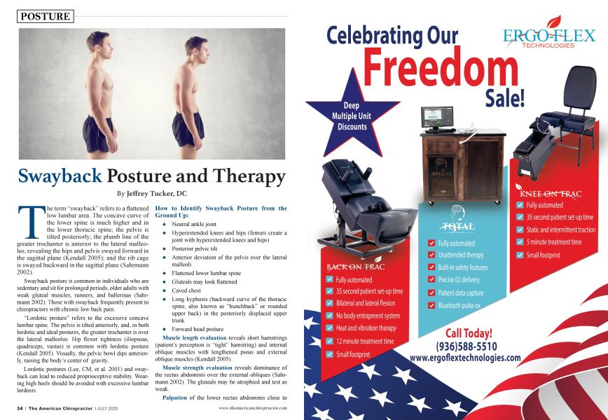 Swayback Posture and Therapy