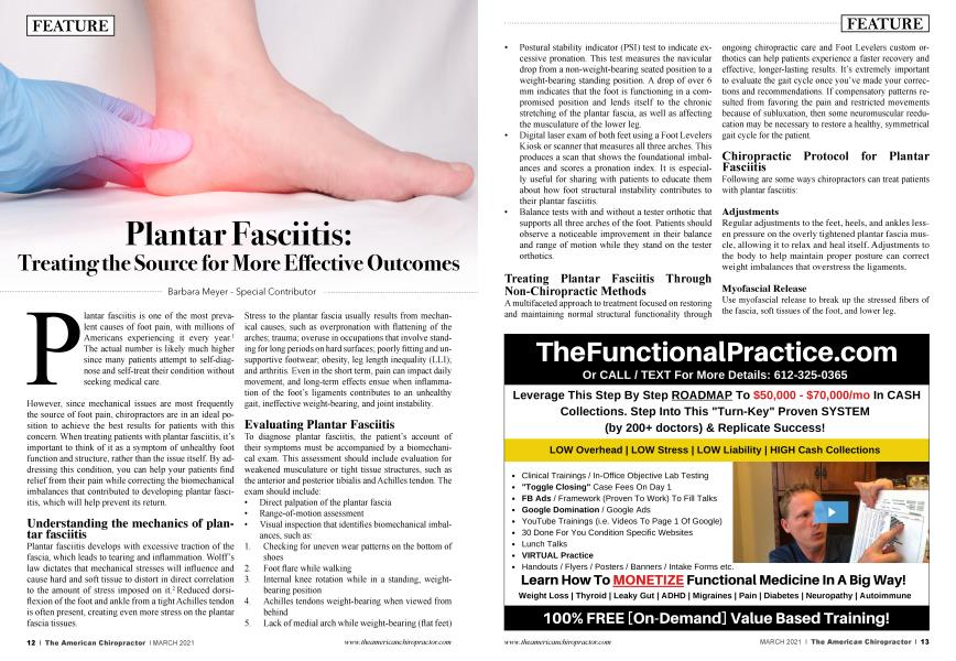 Plantar Fasciitis: Treating the Source for More Effective Outcomes