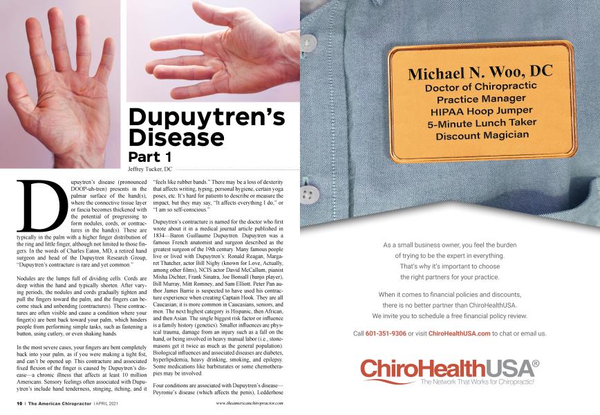 Dupuytren’s Disease