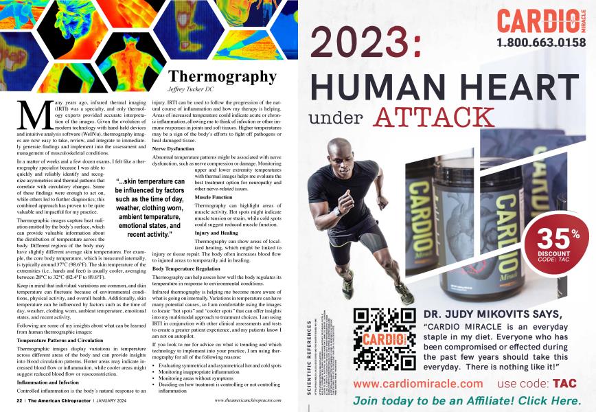 Thermography